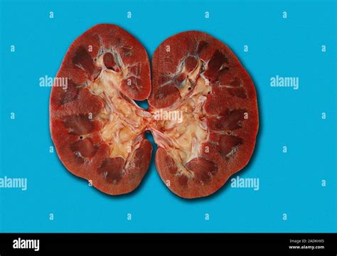 Kidney Gross Anatomy