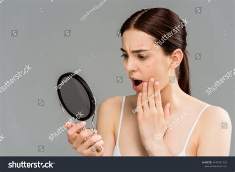 pimple images stock   objects vectors shutterstock
