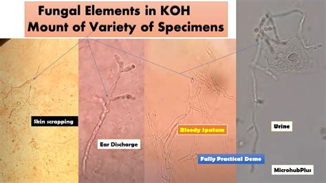 Skin Koh