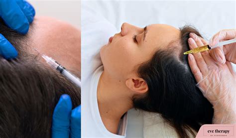 How PRP Works? - Eve Therapy