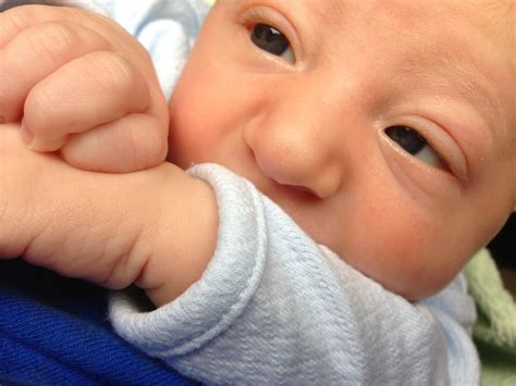 The Ottaway Family | A Blog About Microcephaly: What is Microcephaly?
