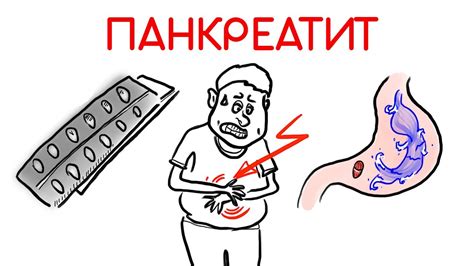 Хронический панкреатит: почему лекарства не помогают? // Доктор Ху ...