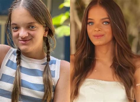 Filha Do Roberto Justus Antes E Depois - Rafa Justus: veja o antes e depois de rinoplastia