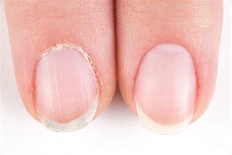 cuticles cuticle care