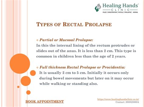 PPT - Rectal Prolapse- Causes, Symptoms and Treatment PowerPoint