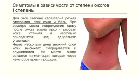 Ожоги. Термические и химические ожоги - презентация онлайн