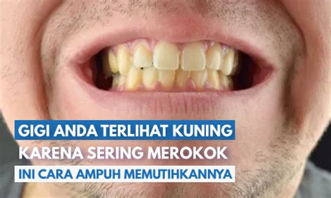 ampuh memutihkan gigi perokok berat perokok wajib baca