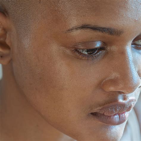 Dicas para cuidar da pele oleosa | SINESTESE Dermocosméticos