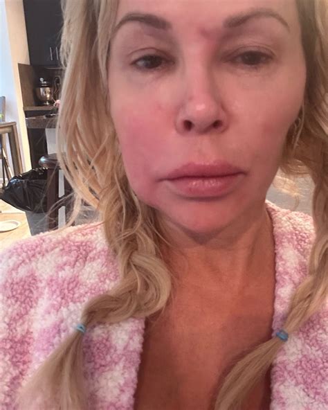 Brandi Glanville Thanks LeAnn Rimes for Help With Face Parasite | Us Weekly