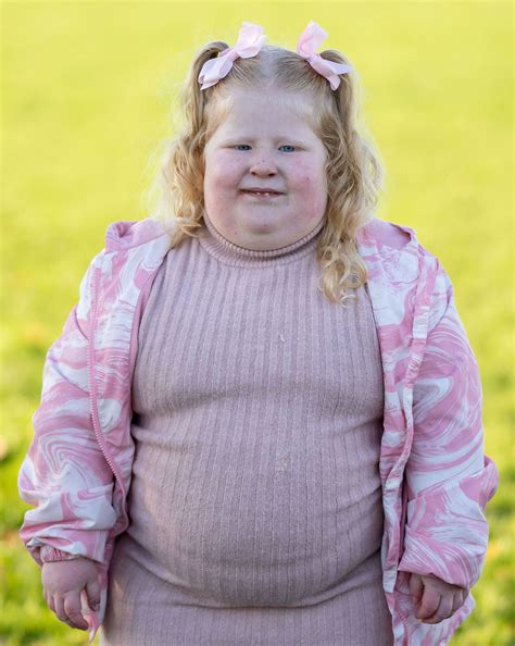 Childhood Obesity