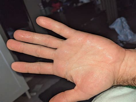 I started treatment last week and I need to know of it works. : r