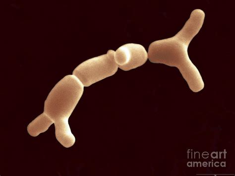 Bifidobacterium Breve Photograph by Scimat - Fine Art America