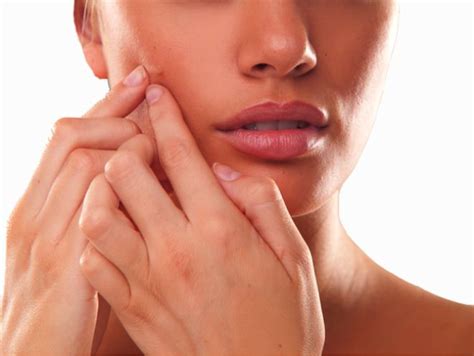 kosia naturals stop picking   face