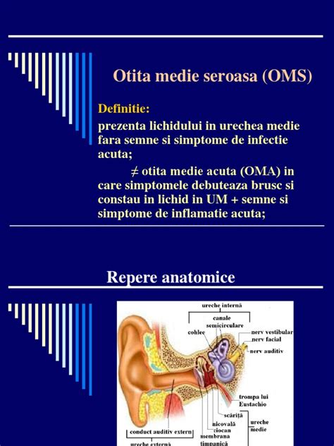 Otita Medie Seroasa -Tratament