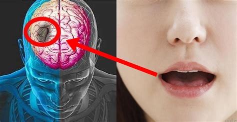 Semne nebănuite care anunță un atac cerebral major