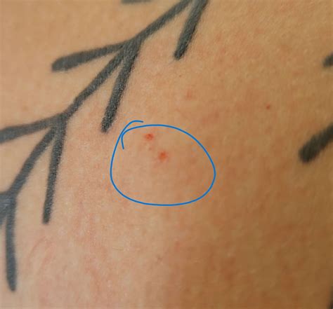 Marca De Mordida De Morcego - Essa picada/mordida pode ser de morcego? : r/BiologiaBrasil