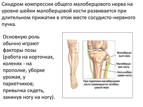 Туннельные синдромы нижней конечности - презентация онлайн