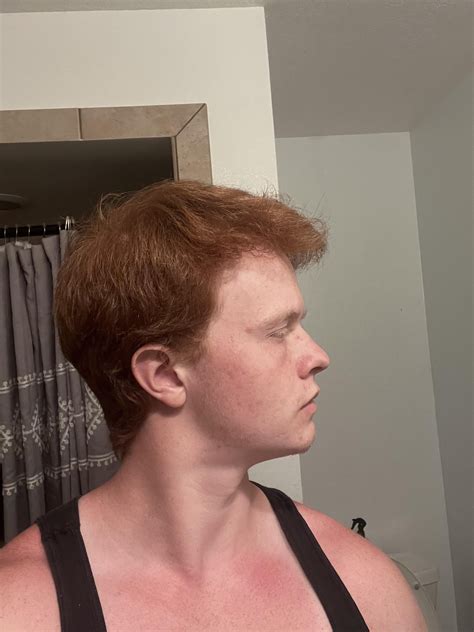 The haircut for balding widows peak that celebrities use to hide age 23