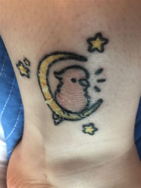 does tattoo peel 1