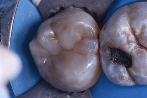 auckland dentist  auckland dentists  auckland dentist