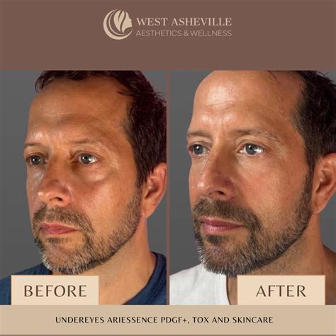 ariessence pdgf asheville regenerative skincare west asheville