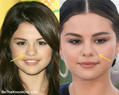 Did Selena Gomez Get A Nose Job - LacoulEuRetleauBe