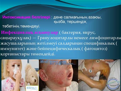 Лейкоз лейкемия (грек. leukos — ақ) - презентация онлайн