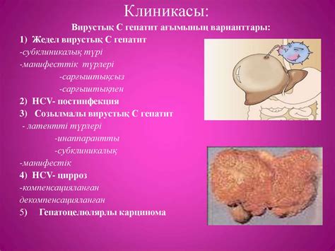 Вирустық С гепатит. Эпидемиологиясы - презентация онлайн
