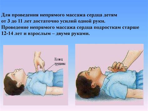 Первая помощь. Комплекс сердечно-легочной реанимации - презентация онлайн