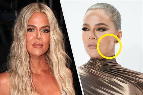 Khloé Kardashian Gave An Update On Her Facial Tumor Scar After Wearing ...