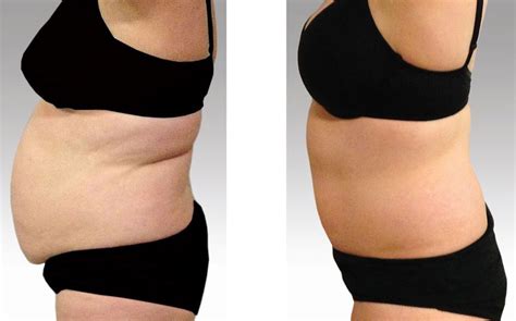 Glacial Definition | Ella Bella Beauty Distribution Ltd