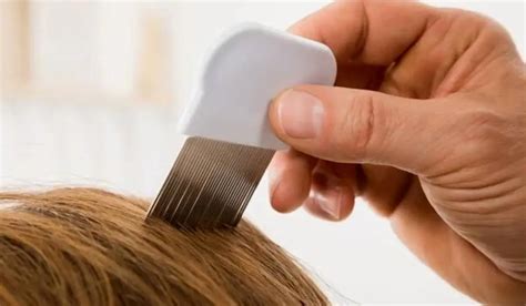 How To Remove Lice From Hair Permanently? Preventions Tips