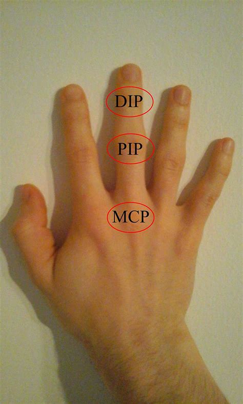 interphalangeal joints   hand wikism sports medicine wiki
