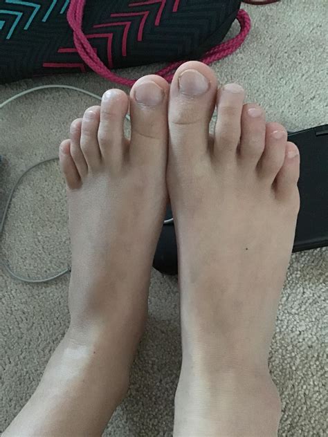 Does anyone know why my pinky toe is bent inwards like this? Tw: feet