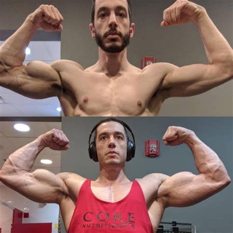 how to know if you tore your bicep