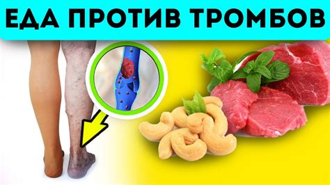 От этих продуктов появляются тромбы! - YouTube