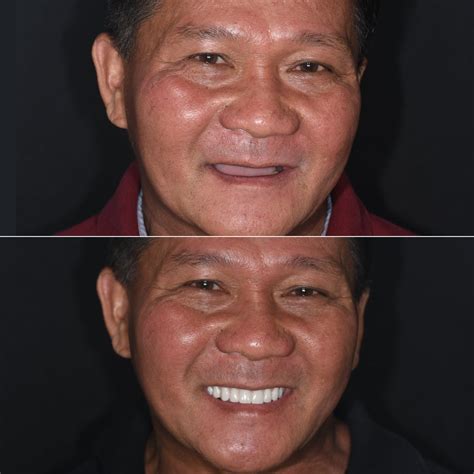 Check... - Compendium of Continuing Education in Dentistry