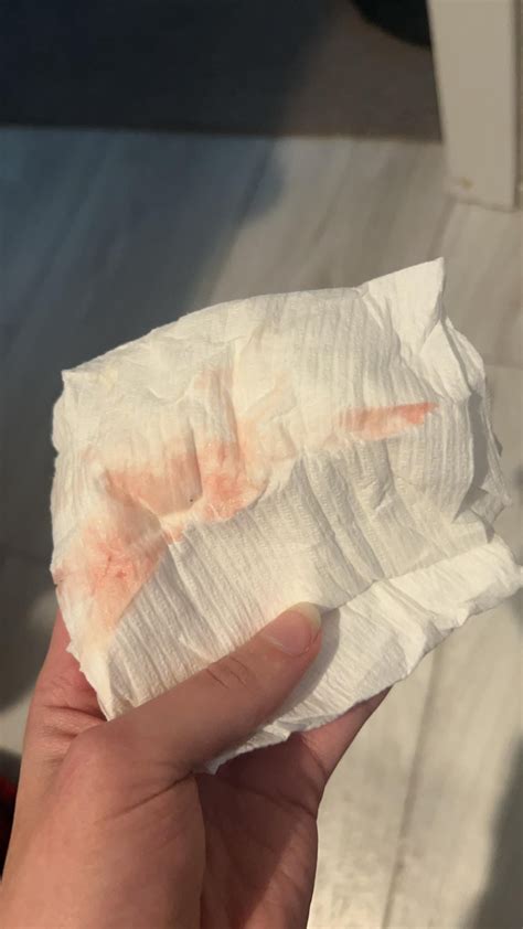 Implantation Bleeding At 6 Weeks Bleeding At 6 Weeks Pregnant?