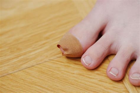 My Side of Toenail Hurts But Isn’t Ingrown | What Gives?