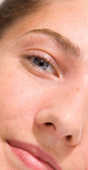 Hiperkeratoza: przyczyny, skutki i rozwiązania | Eau Thermale Avène