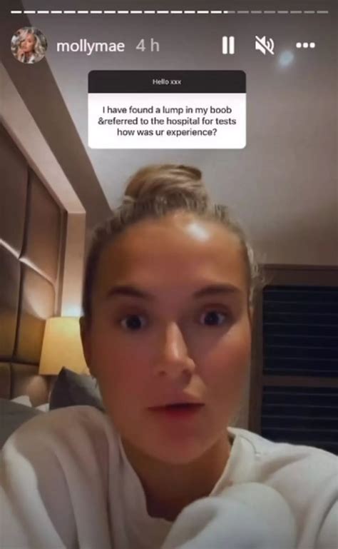 Molly-Mae Hague shares scar on boob where lump was removed after cancer