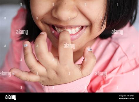 portrait  child showing  teeth stock photo alamy