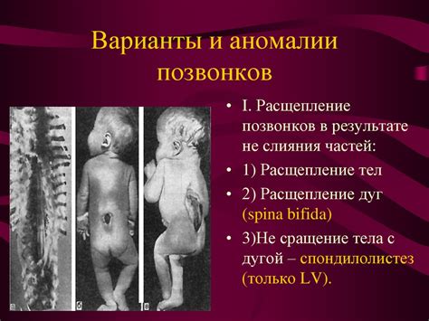 Скелет туловища и конечностей - презентация онлайн