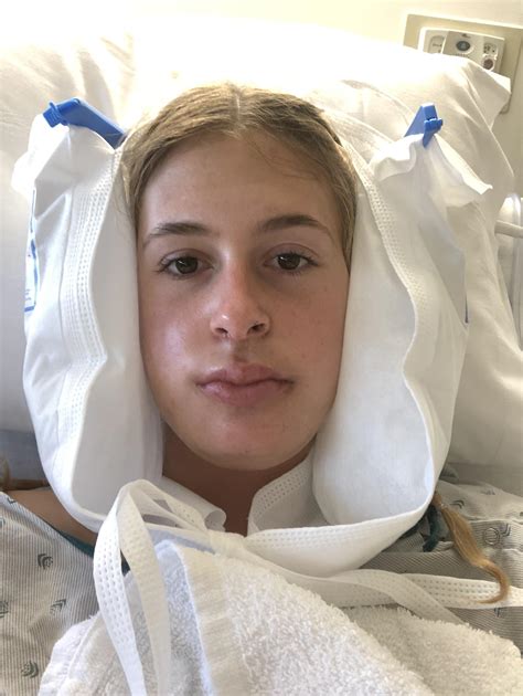 Almost 24 hours post op! | Scrolller
