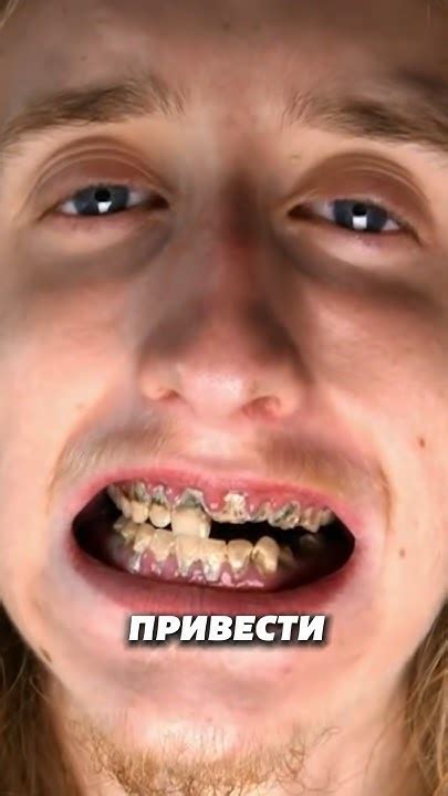Что будет если скрипеть зубами ? 😬 - YouTube