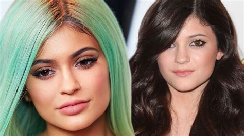 kylie jenner  changing face   youngest kardashian  lip