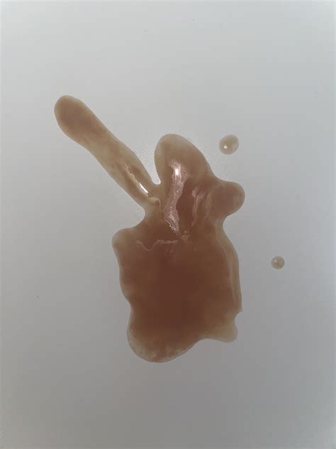 Oddly colored Semen? : r/DiagnoseMe