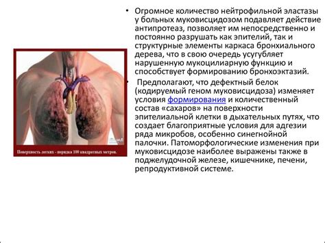 Муковисцидоз - презентация онлайн