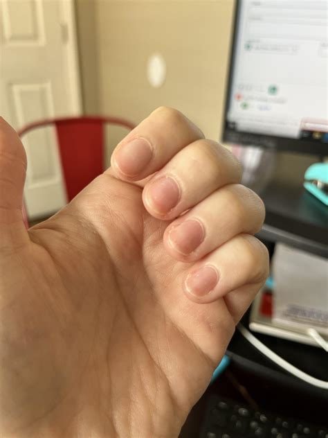 Dry nails/cuticles : r/Skincare_Addiction