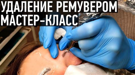 Удаление татуажа ремувером - мастер-класс от Ирины Ткачук - YouTube